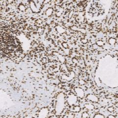 兔抗人ARID1A单克隆抗体 TDCAR-0240