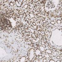 兔抗人ARID1A单克隆抗体 TDCAR-0240