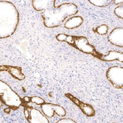 鼠抗人细胞角蛋白（高分子量）单克隆抗体  TDCCM-0900