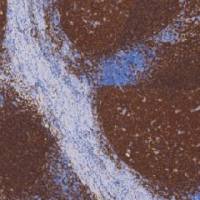 鼠抗人CD20单克隆抗体 TDCCM-0460