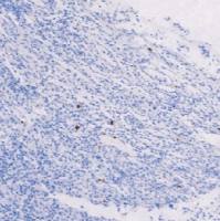 鼠抗人巨细胞病毒单克隆抗体 TDCCM-0890