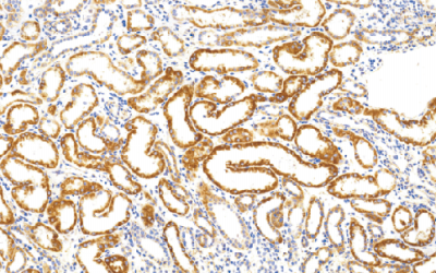鼠抗人琥珀酸脱氢酶复合体亚基B单克隆抗体 TDCSM-02