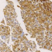 鼠抗人组织蛋白酶-K单克隆抗体  TDCCM-0290