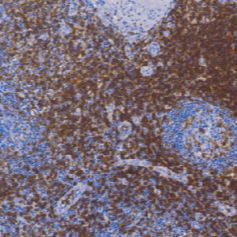 鼠抗人CD5单克隆抗体  TDCCM-0354