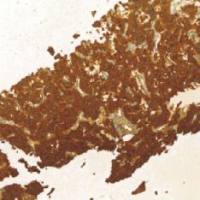 兔抗人降钙素多克隆抗体 TDCCR-0190