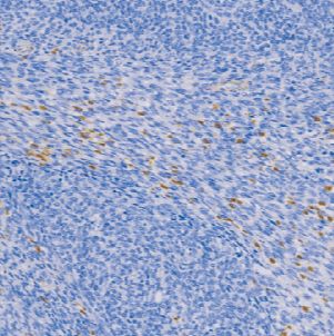 鼠抗人膜黏连蛋白A1单克隆抗体  TDCAM-0220
