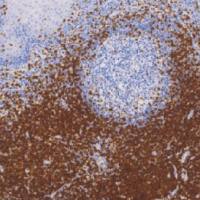 鼠抗人CD3单克隆抗体  TDCCM-0332