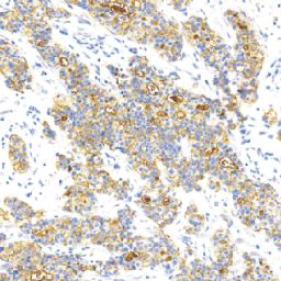 鼠抗人BCA-225单克隆抗体 TDCBM-0020