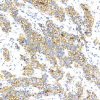 鼠抗人BCA-225单克隆抗体 TDCBM-0020