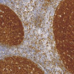 鼠抗人B 细胞特异性八聚体结合蛋白-1单克隆抗体 TDCBM-0080