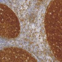 鼠抗人B 细胞特异性八聚体结合蛋白-1单克隆抗体 TDCBM-0080