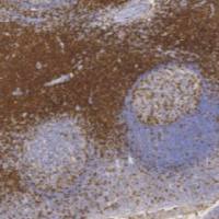 鼠抗人CD7单克隆抗体  TDCCM-0362