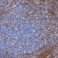 兔抗人CD2单克隆抗体  TDCCR-0321