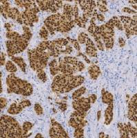 兔抗人雄激素受体单克隆抗体  TDCAR-0210