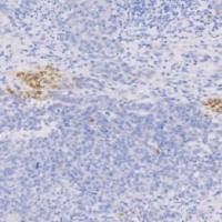 兔抗人BraCHyury单克隆抗体 TDCBR-0120