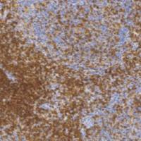 兔抗人CD4单克隆抗体 TDCCR-0343