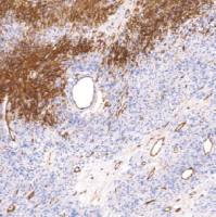 鼠抗人CD34(内皮细胞标记物)单克隆抗体 TDCCM-0550