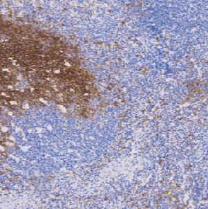鼠抗人CD23单克隆抗体  TDCCM-0483