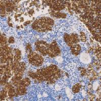 鼠抗人KBA.62单克隆抗体 TDCKM-0020