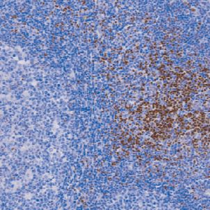 兔抗人LEF1单克隆抗体  TDCLR-0080