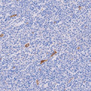 兔抗人CD105单克隆抗体  TDCCR-1191