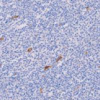 兔抗人CD105单克隆抗体  TDCCR-1191