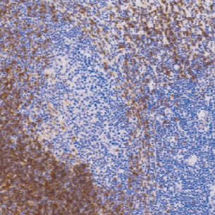 兔抗人免疫球蛋白D多克隆抗体  TDCIR-0111