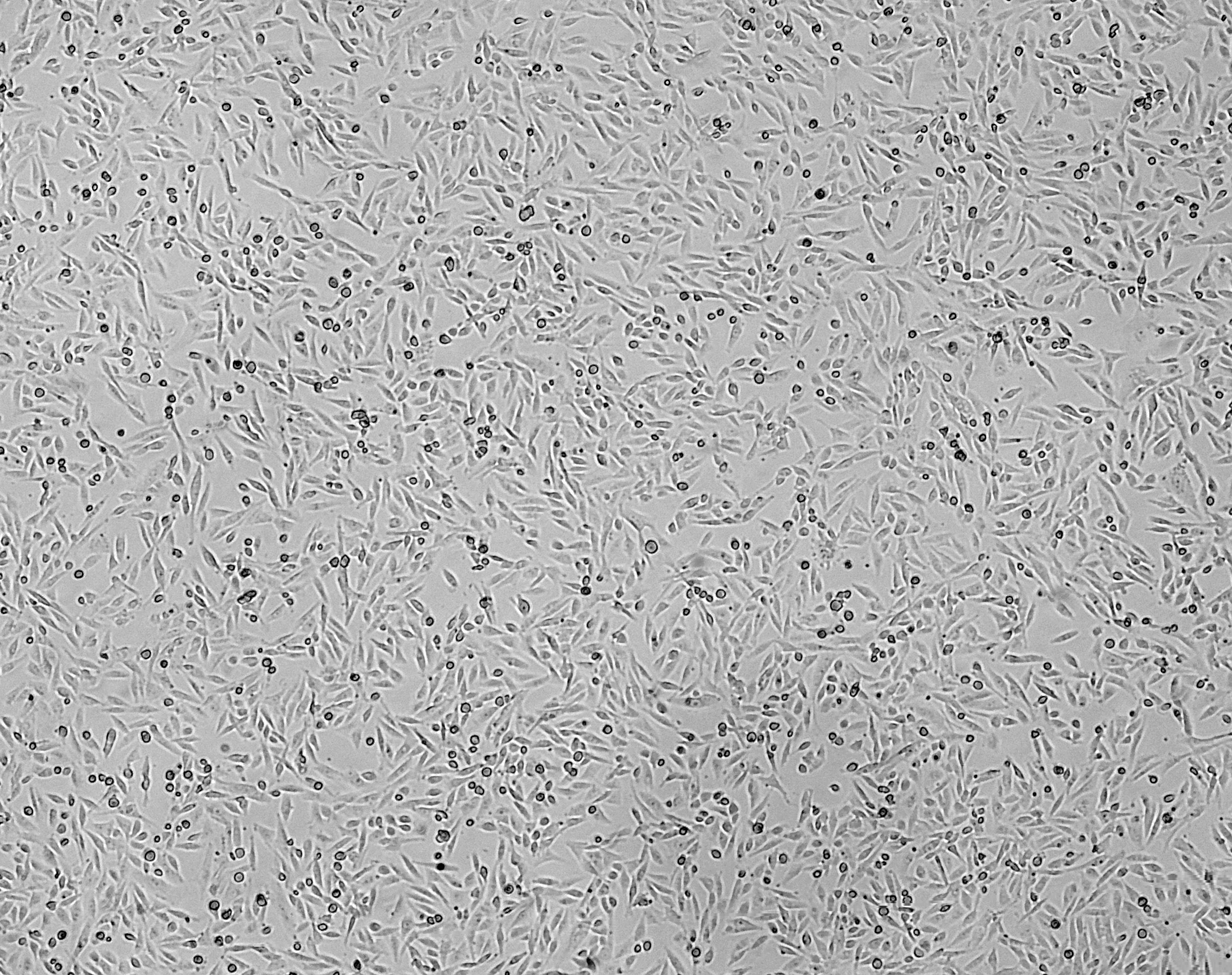 细胞攻略 | MDA-MB-231(人乳腺癌细胞)培养教程