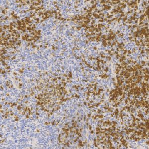 兔抗人CD99单克隆抗体  TDCCR-0741