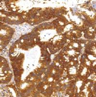 鼠抗人肺耐药相关蛋白单克隆抗体 TDCLM-0040