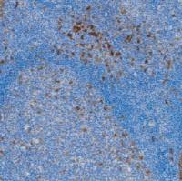 鼠抗人CD30单克隆抗体 TDCCM-0523