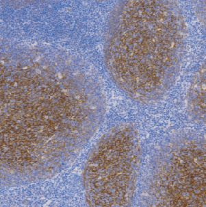 兔抗人CD35单克隆抗体  TDCCR-0561