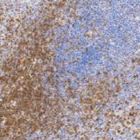 鼠抗人CD43单克隆抗体 TDCCM-0590