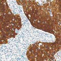 鼠抗人热休克蛋白27单克隆抗体  TDCHM-0150