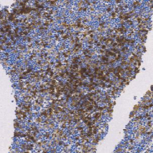 兔抗人HLA-DR α链单克隆抗体  TDCHR-0300