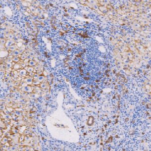 兔抗人CD138单克隆抗体 TDCCR-0781