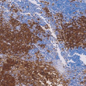 鼠抗人CD63单克隆抗体 TDCCM-0690