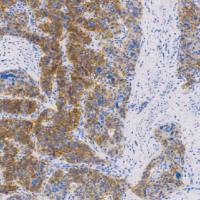 鼠抗人CD56单克隆抗体  TDCCM-0662