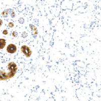 兔抗人乳腺球蛋白单克隆抗体 TDCMR-0111