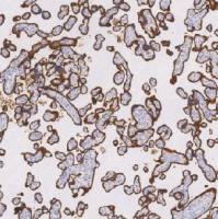 鼠抗人CD71单克隆抗体 TDCCM-0710