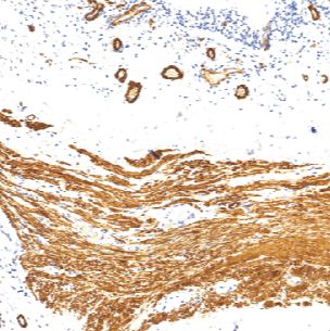 鼠抗人上皮膜抗原单克隆抗体  TDCEM-0041