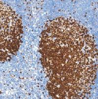 鼠抗人Ki-67抗原单克隆抗体  TDCKM-0032