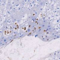 鼠抗人乳头瘤病毒16单克隆抗体 TDCHM-0260