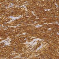 兔抗人CD117单克隆抗体 TDCCR-0760