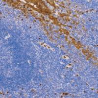 兔抗人缺氧诱导因子1α单克隆抗体 TDCHR-0310