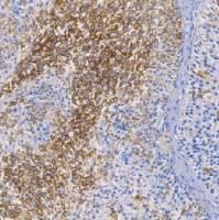 鼠抗人CD44变异体6单克隆抗体 TDCCM-0610