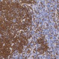 鼠抗人CD79a单克隆抗体  TDCCM-0734