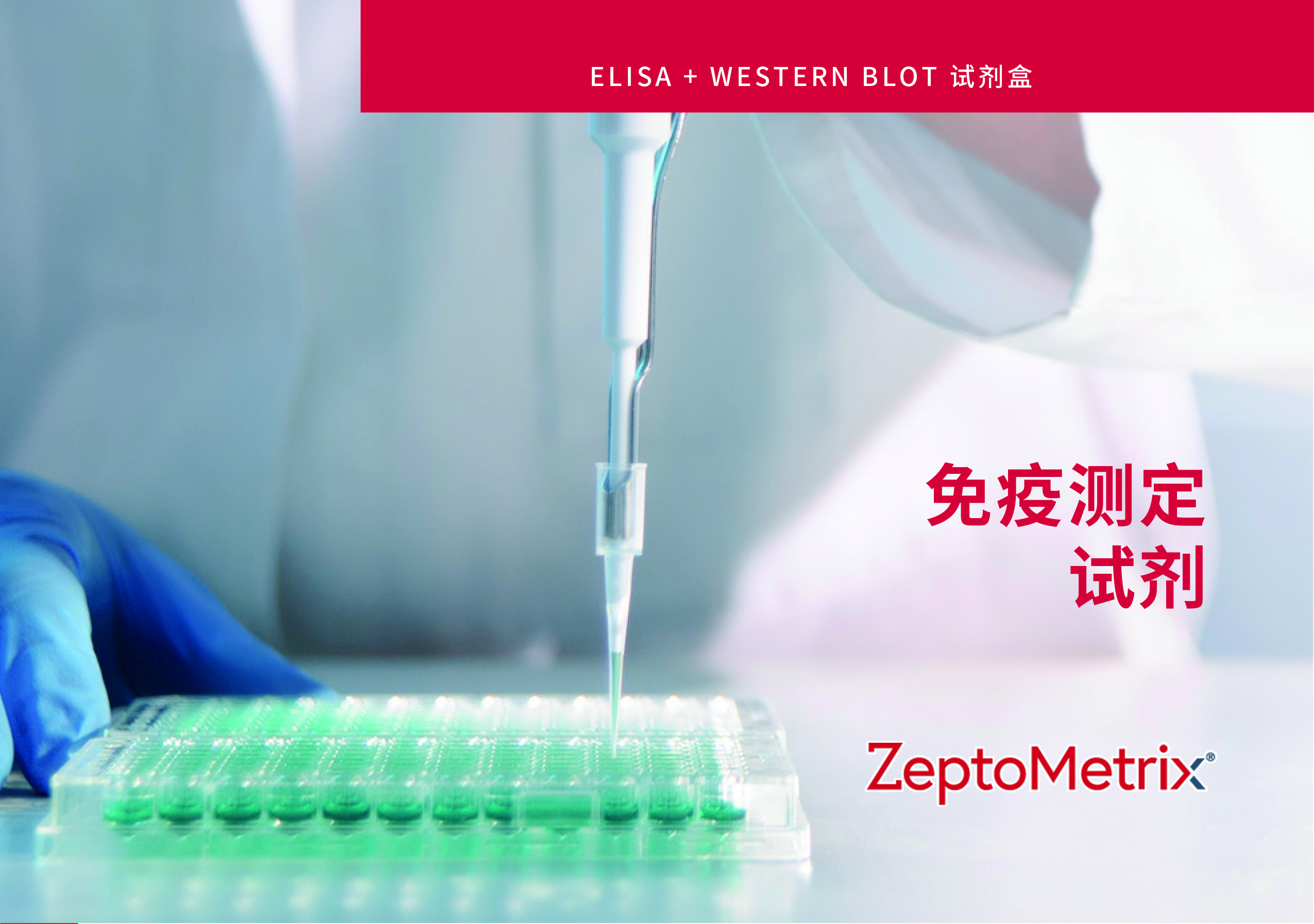 产品推介 | ZeptoMetrix 免疫测定 ELISA+WB 试剂