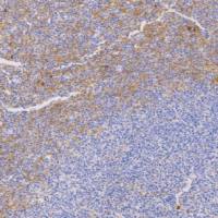 鼠抗人CD38单克隆抗体  TDCCM-0572