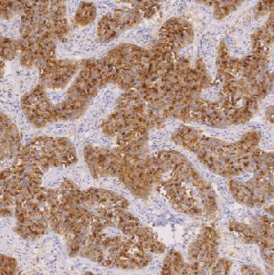 鼠抗人囊泡病液体蛋白-15单克隆抗体  TDCGM-0140